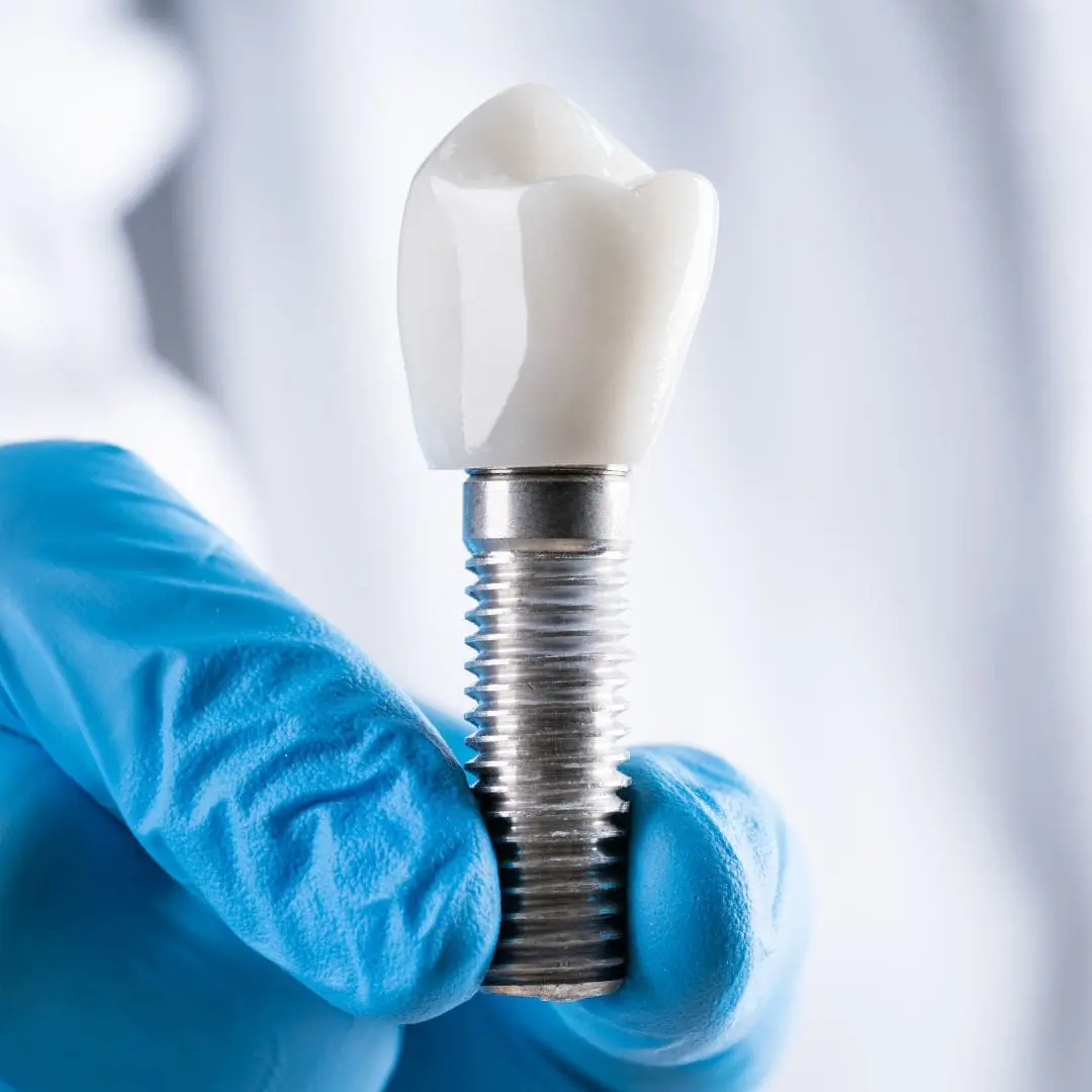 Fallowfield Dental Center_Ottawa_Nepean_Barrhaven (21)