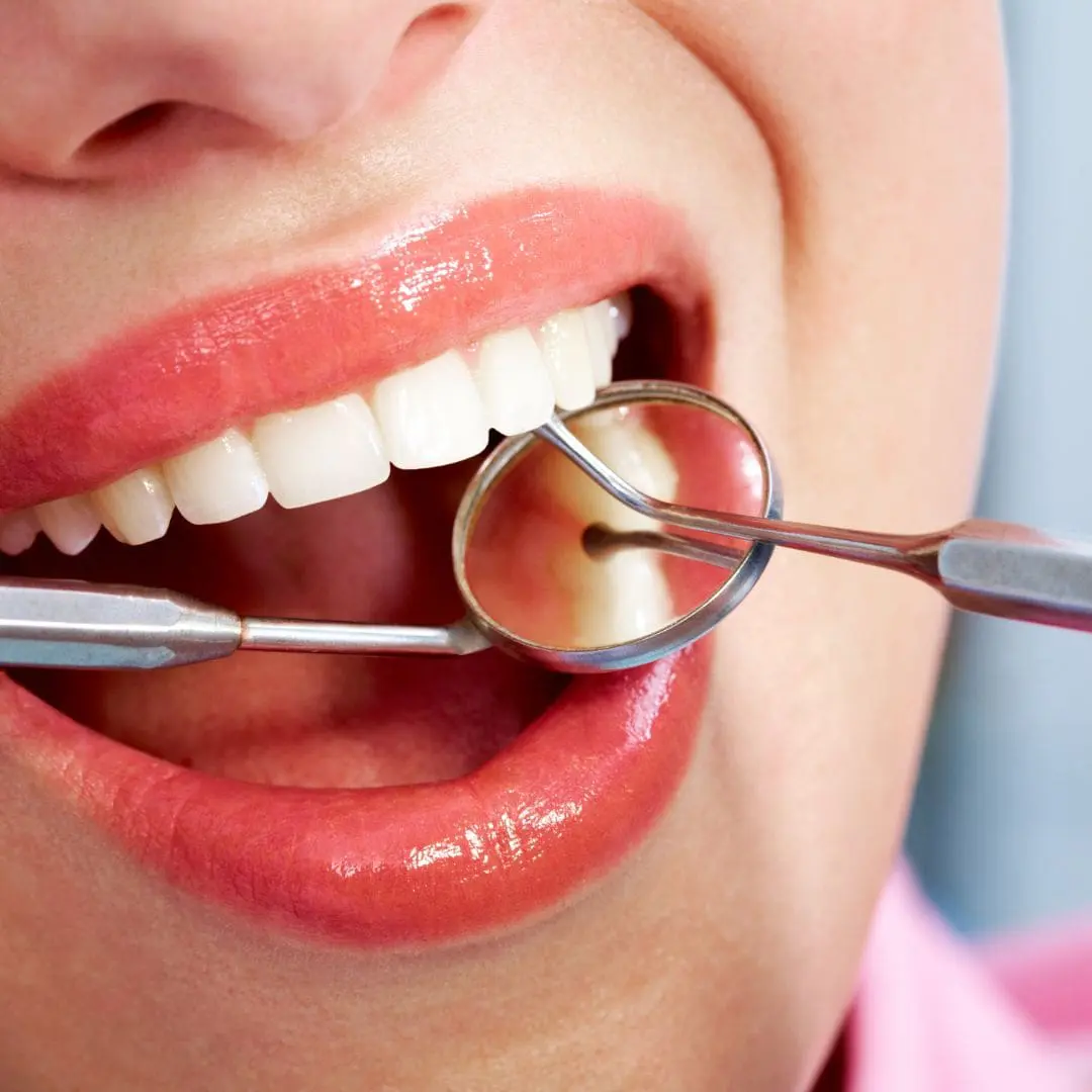 Fallowfield Dental Center_Ottawa_Nepean_Barrhaven (3)