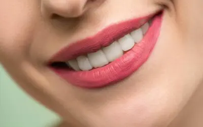 How Much Does Teeth Whitening Cost in Ottawa?