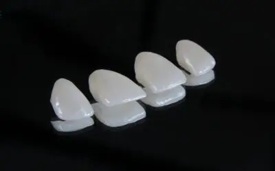 Dental Bonding vs Veneers: What’s Right for Your Smile?