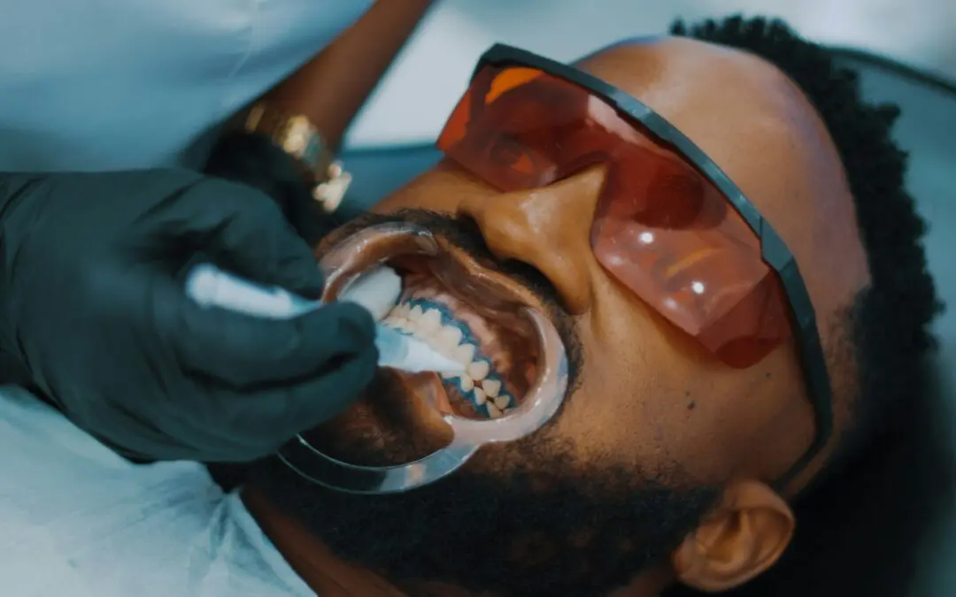 Teeth Whitening vs. Dental Bonding: Which is Right for Your Smile?
