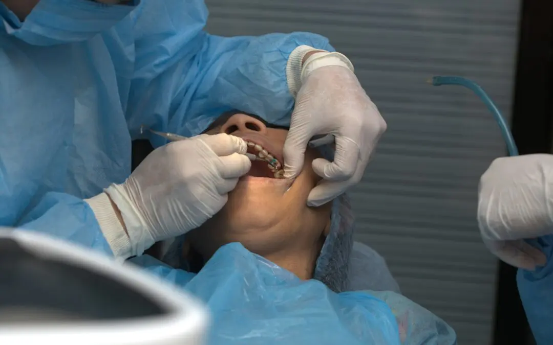 When to Get Your Wisdom Teeth Removed